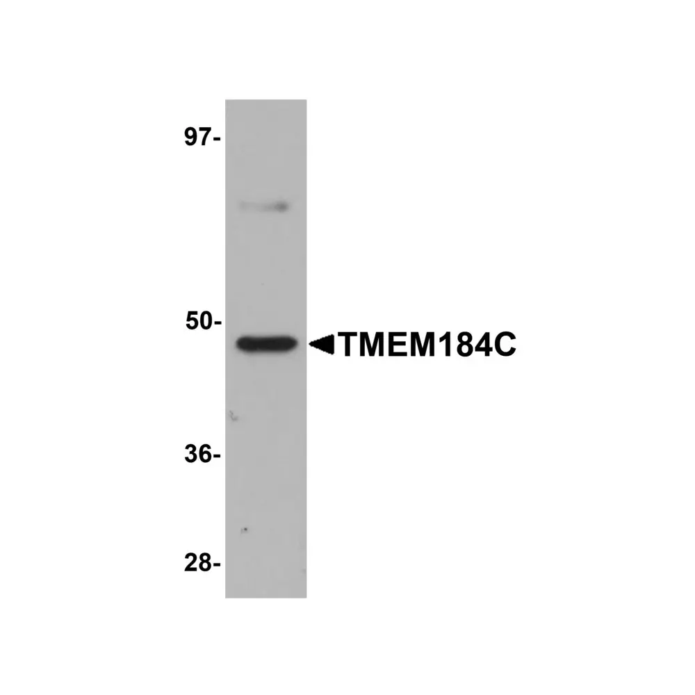 ProSci 5685 TMEM184C Antibody, ProSci, 0.1 mg/Unit Primary Image