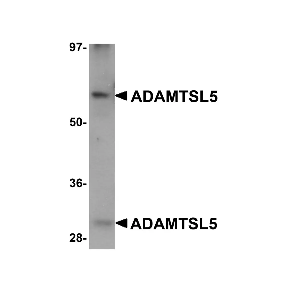 ProSci 5687 ADAMTSL5 Antibody, ProSci, 0.1 mg/Unit Primary Image
