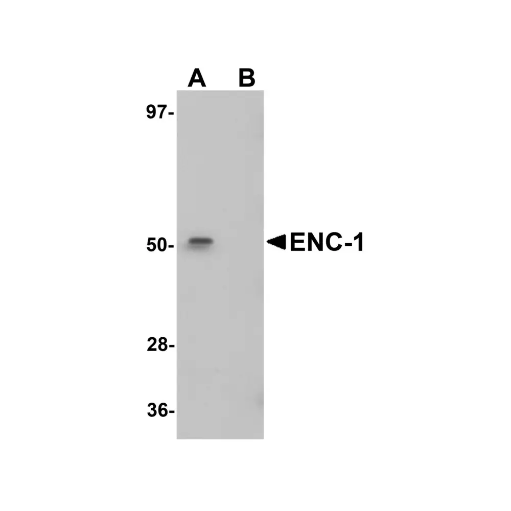 ProSci 5693 ENC-1 Antibody, ProSci, 0.1 mg/Unit Primary Image