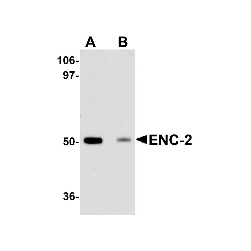 ProSci 5695_S ENC-2 Antibody, ProSci, 0.02 mg/Unit Primary Image