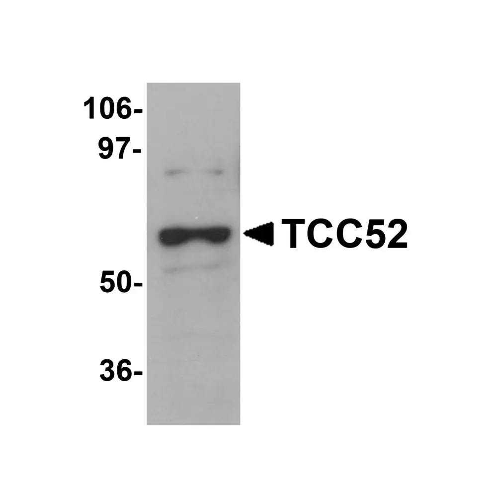 ProSci 5703 TCC52 Antibody, ProSci, 0.1 mg/Unit Primary Image