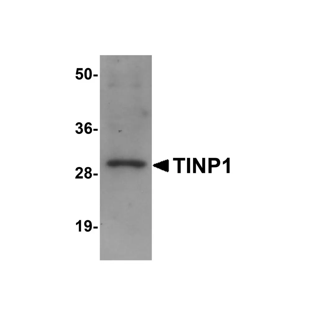 ProSci 5705 TINP1 Antibody, ProSci, 0.1 mg/Unit Primary Image