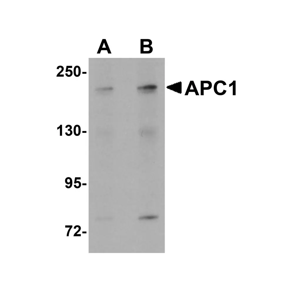 ProSci 5717 APC1 Antibody, ProSci, 0.1 mg/Unit Primary Image