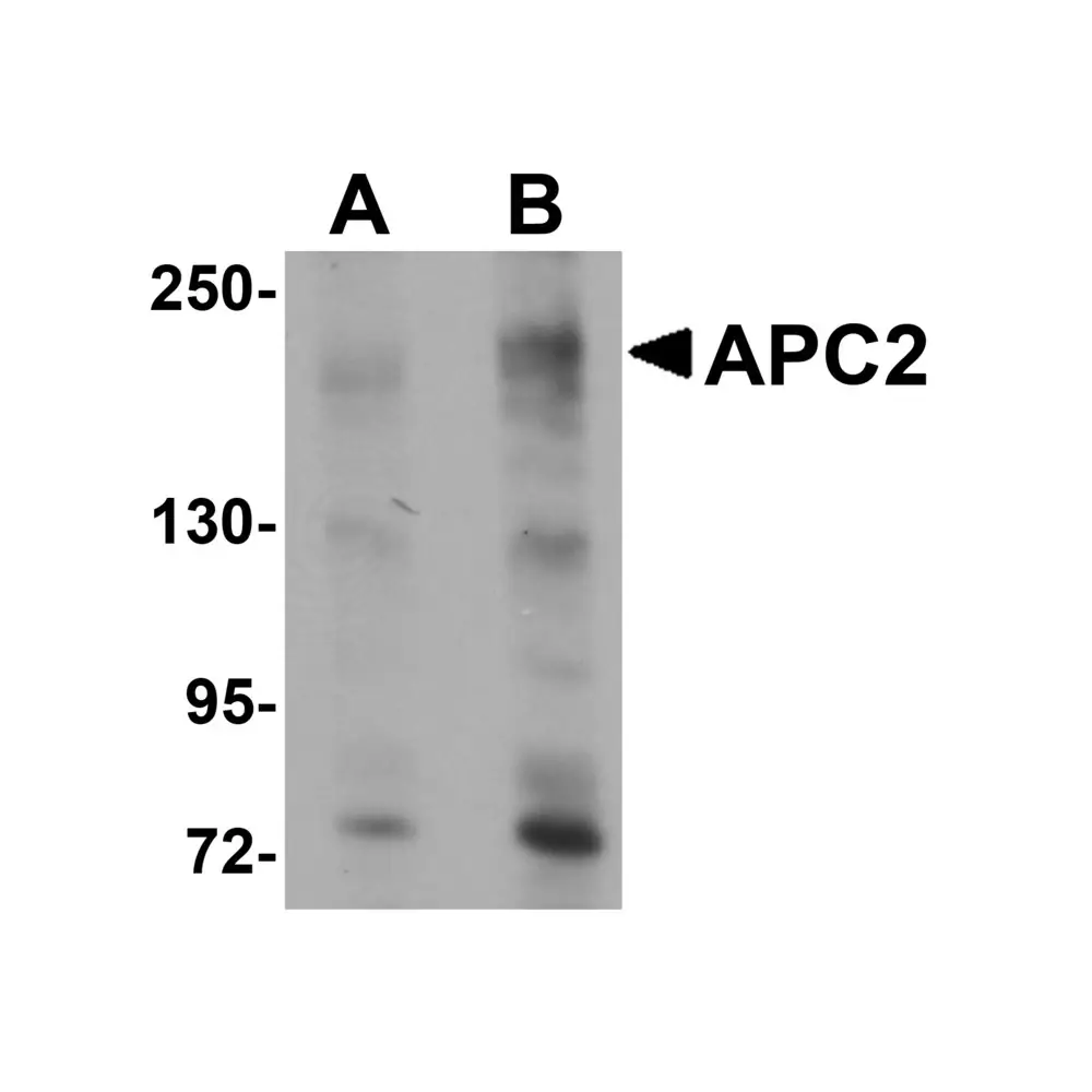 ProSci 5721 APC2 Antibody, ProSci, 0.1 mg/Unit Primary Image