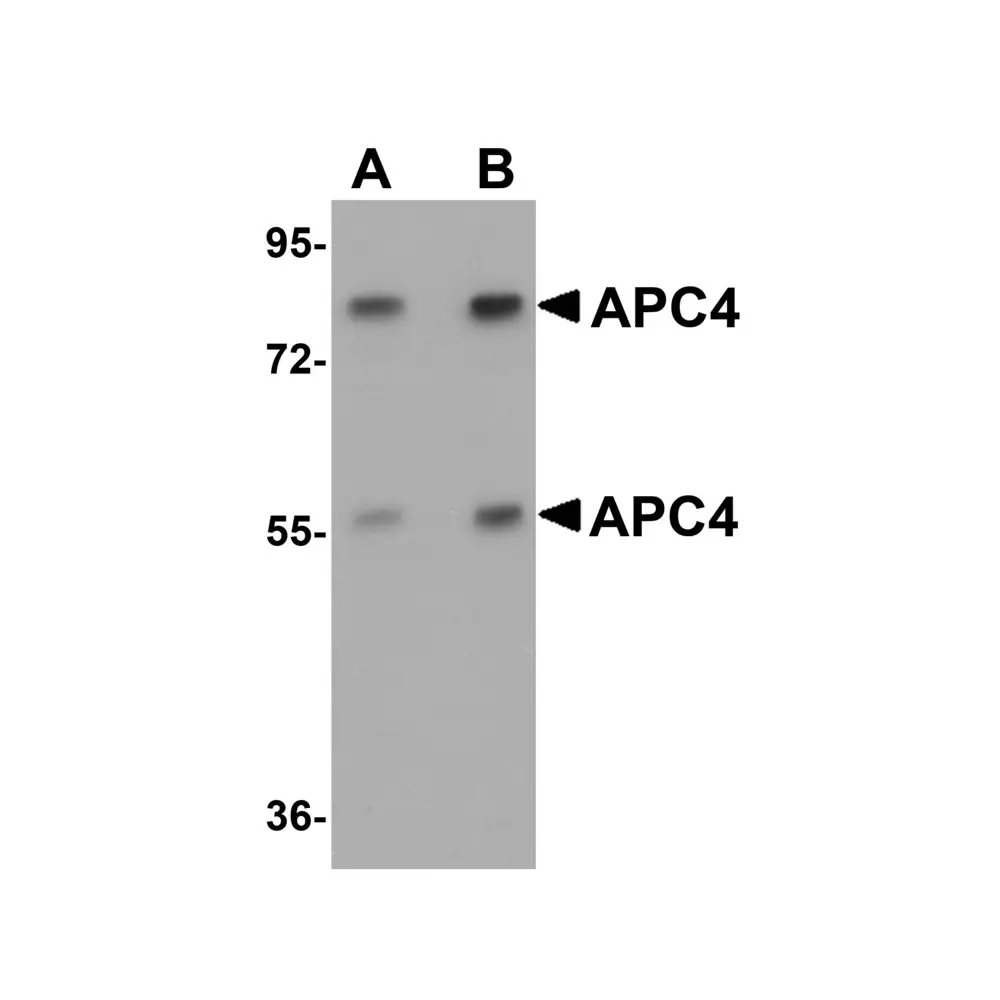 ProSci 5725 APC4 Antibody, ProSci, 0.1 mg/Unit Primary Image