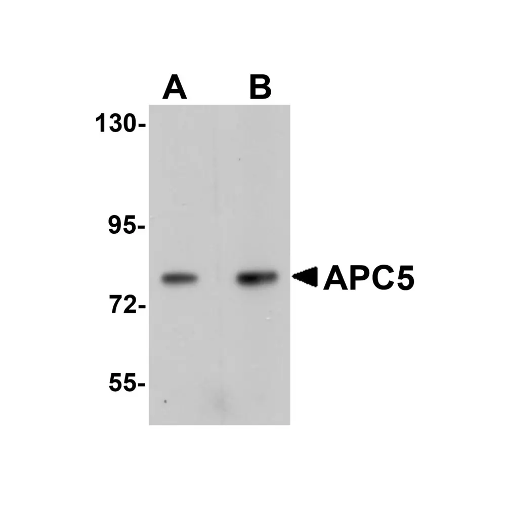 ProSci 5727 APC5 Antibody, ProSci, 0.1 mg/Unit Primary Image