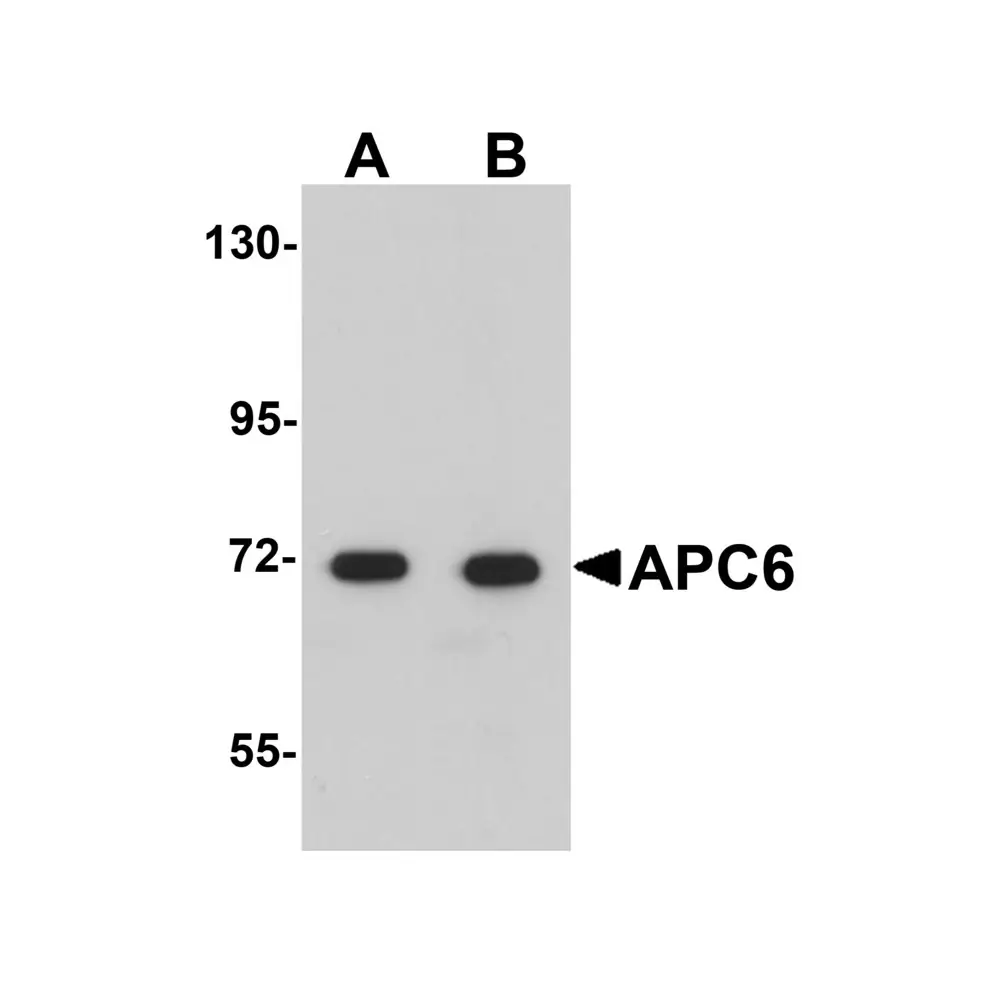 ProSci 5729 APC6 Antibody, ProSci, 0.1 mg/Unit Primary Image