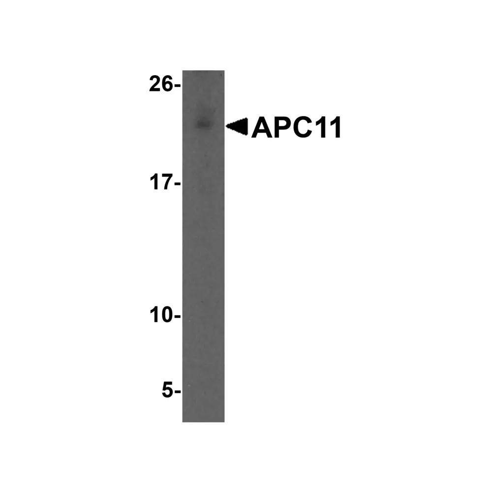 ProSci 5737 APC11 Antibody, ProSci, 0.1 mg/Unit Primary Image