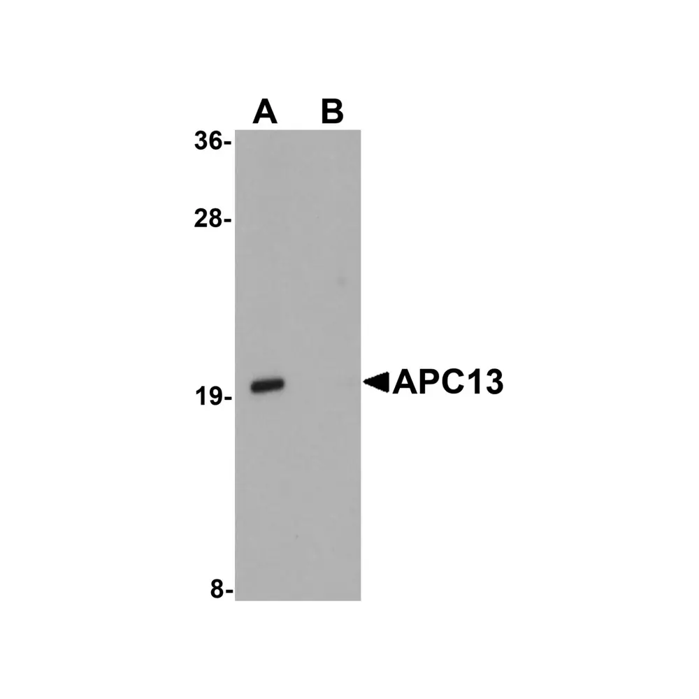 ProSci 5739 APC13 Antibody, ProSci, 0.1 mg/Unit Primary Image