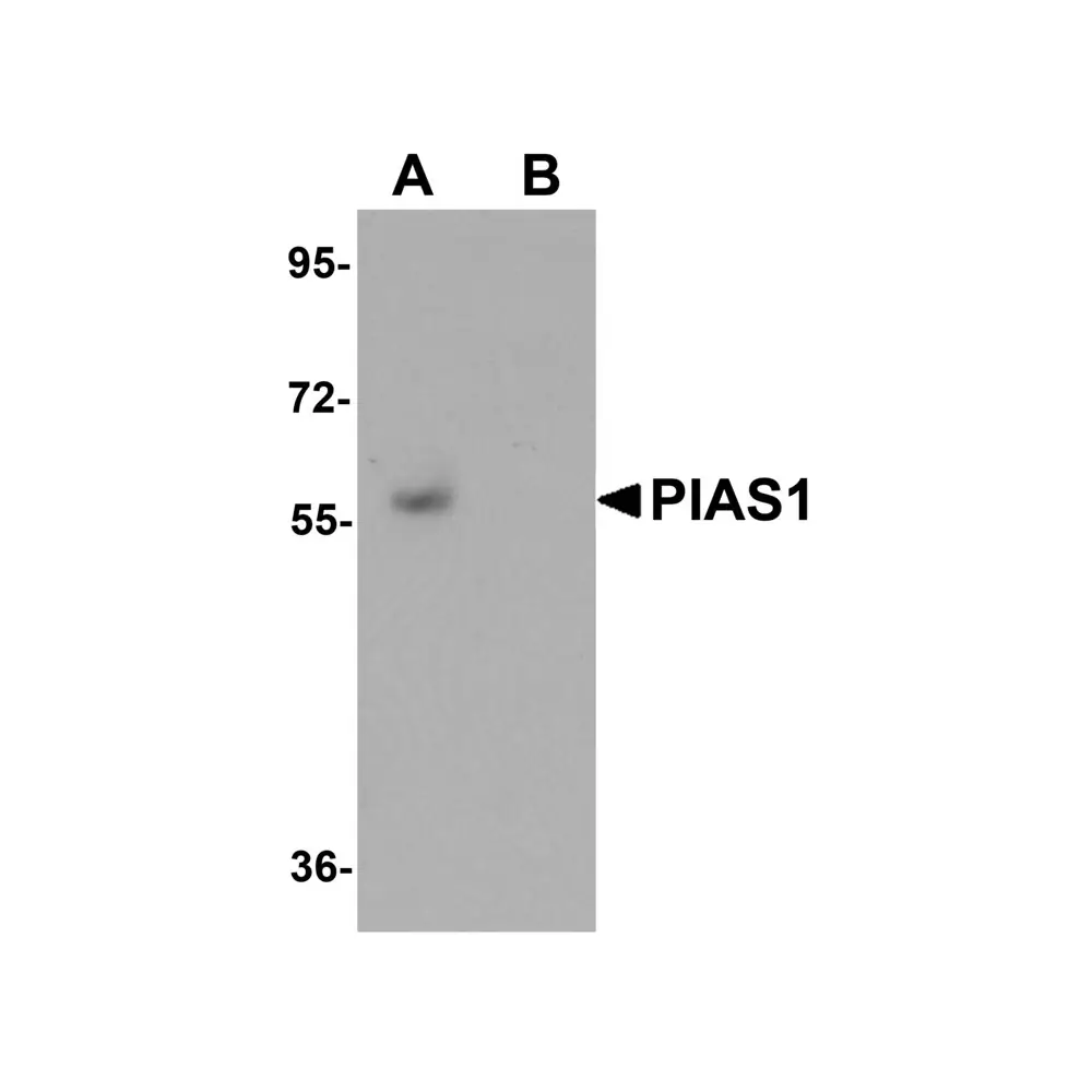 ProSci 5741_S PIAS1 Antibody, ProSci, 0.02 mg/Unit Primary Image