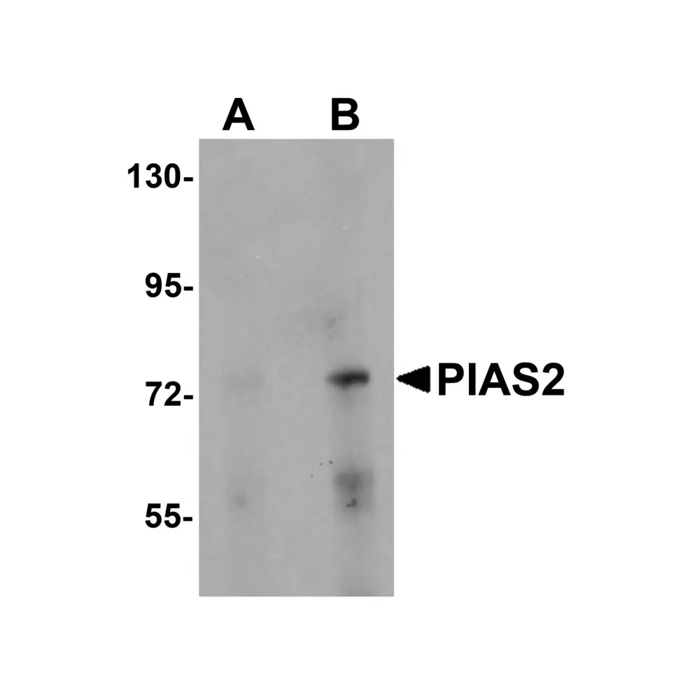 ProSci 5743_S PIAS2 Antibody, ProSci, 0.02 mg/Unit Primary Image