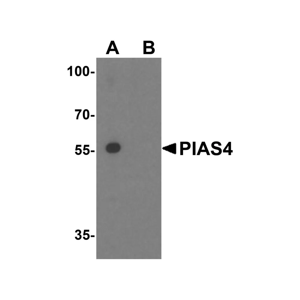 ProSci 5747_S PIAS4 Antibody, ProSci, 0.02 mg/Unit Primary Image