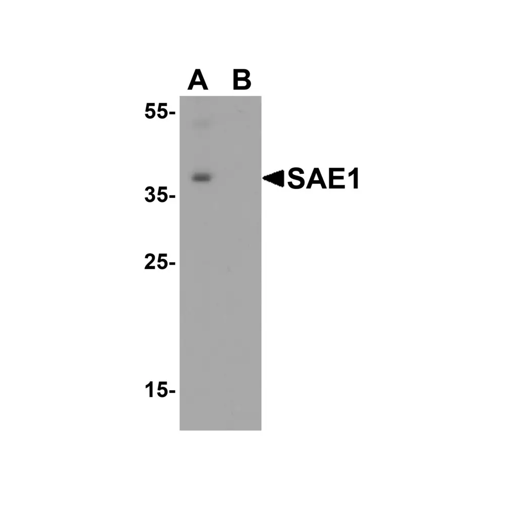 ProSci 5749 SAE1 Antibody, ProSci, 0.1 mg/Unit Primary Image