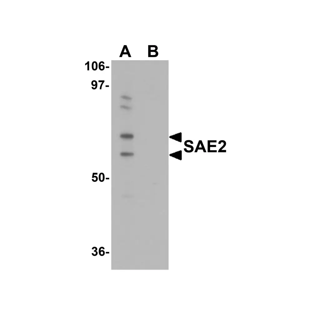 ProSci 5751 SAE2 Antibody, ProSci, 0.1 mg/Unit Primary Image