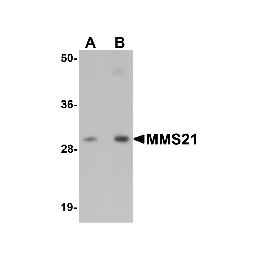 ProSci 5759 MMS21 Antibody, ProSci, 0.1 mg/Unit Primary Image