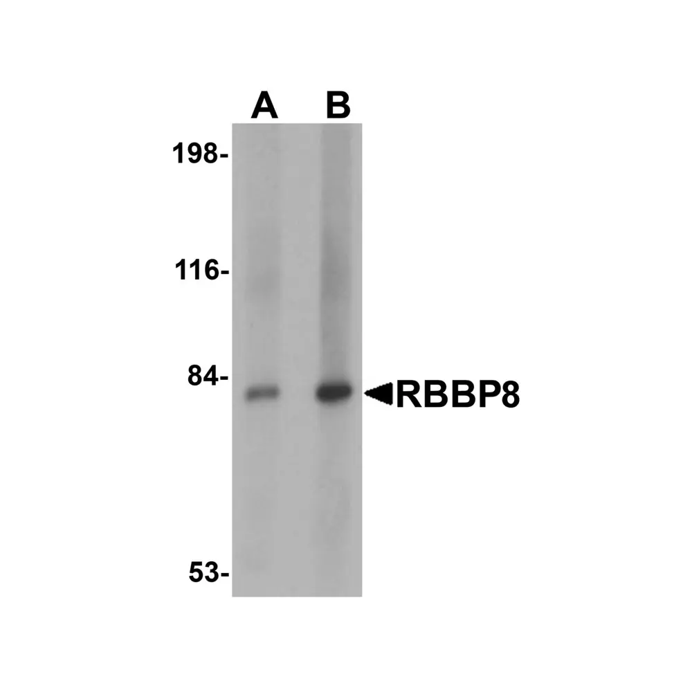 ProSci 5761_S RBBP8 Antibody, ProSci, 0.02 mg/Unit Primary Image