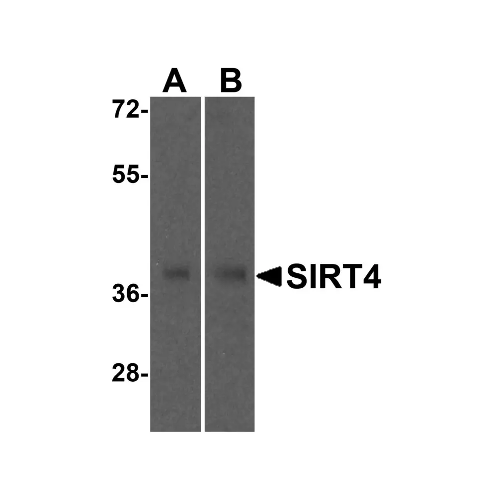 ProSci 5769_S SIRT4 Antibody, ProSci, 0.02 mg/Unit Primary Image