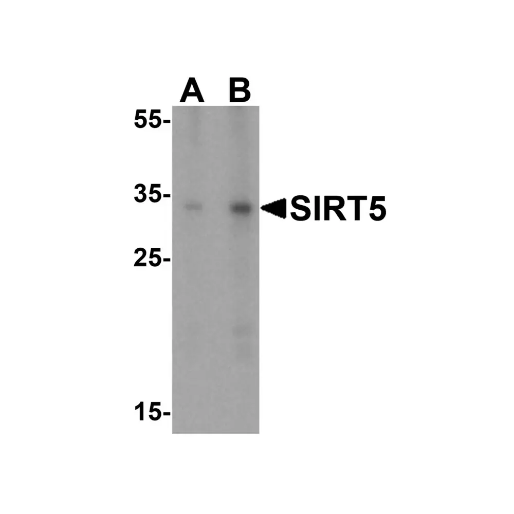 ProSci 5771 SIRT5 Antibody, ProSci, 0.1 mg/Unit Primary Image