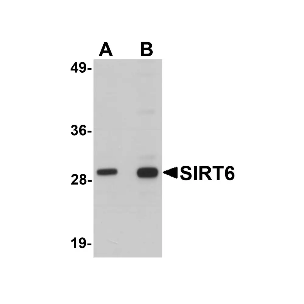 ProSci 5773 SIRT6 Antibody, ProSci, 0.1 mg/Unit Primary Image