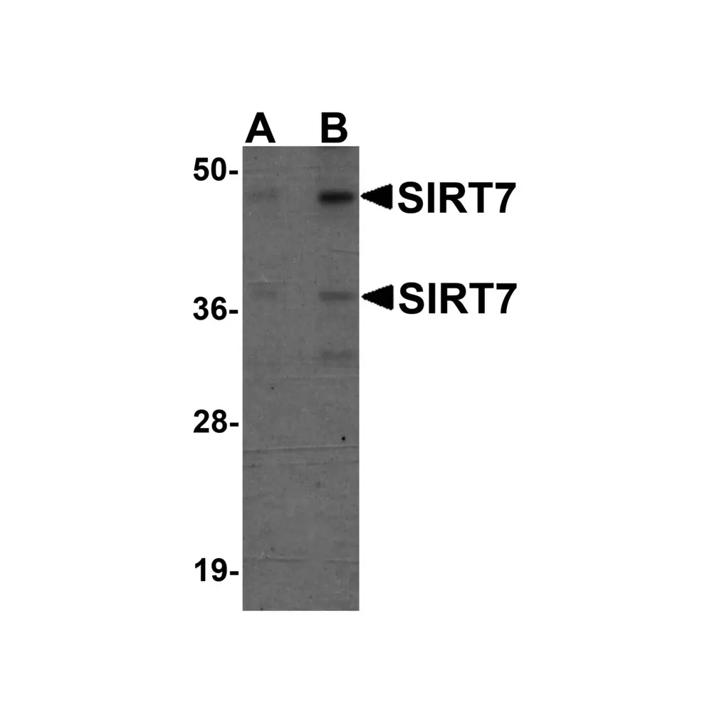 ProSci 5775 SIRT7 Antibody, ProSci, 0.1 mg/Unit Primary Image