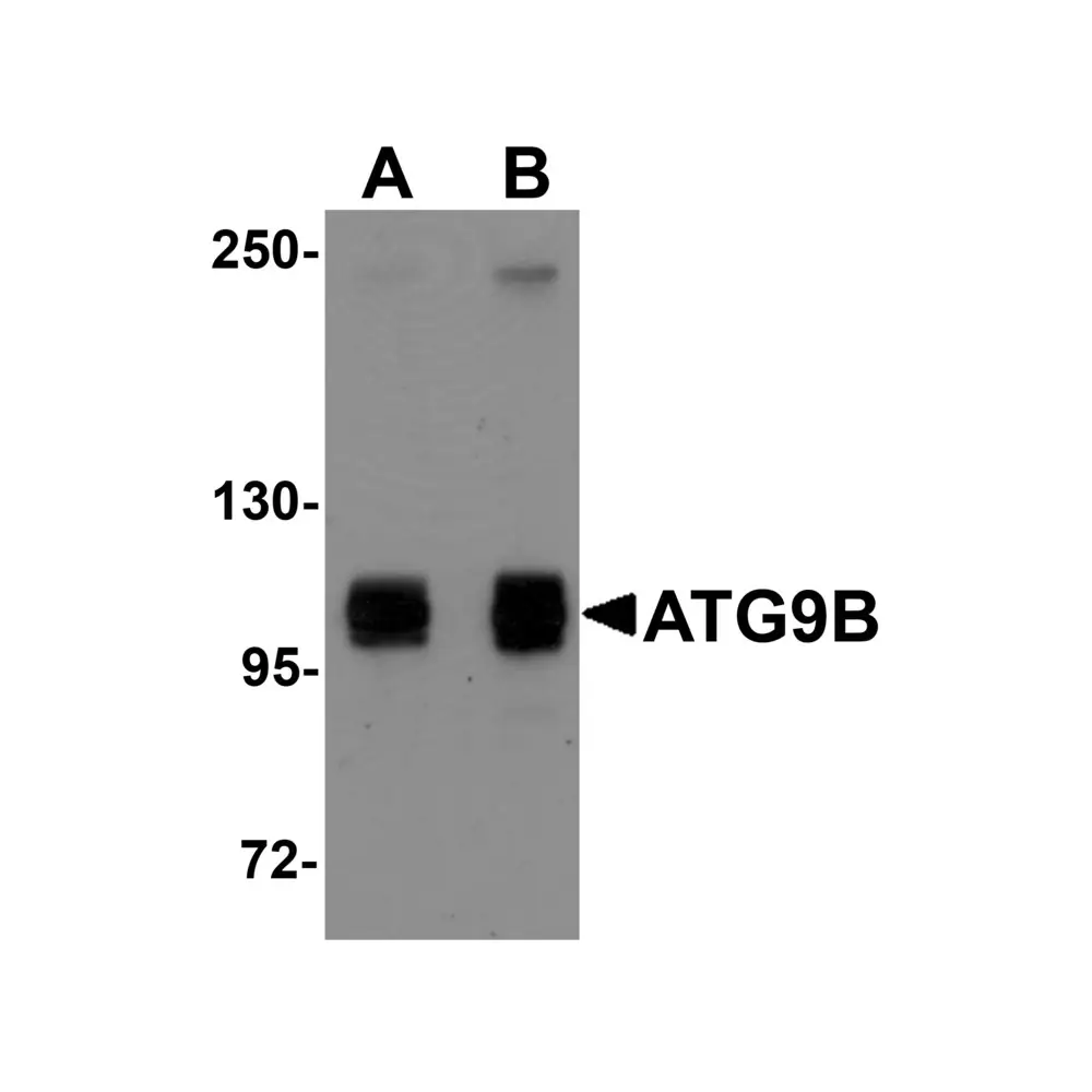ProSci 5797_S ATG9B Antibody, ProSci, 0.02 mg/Unit Primary Image