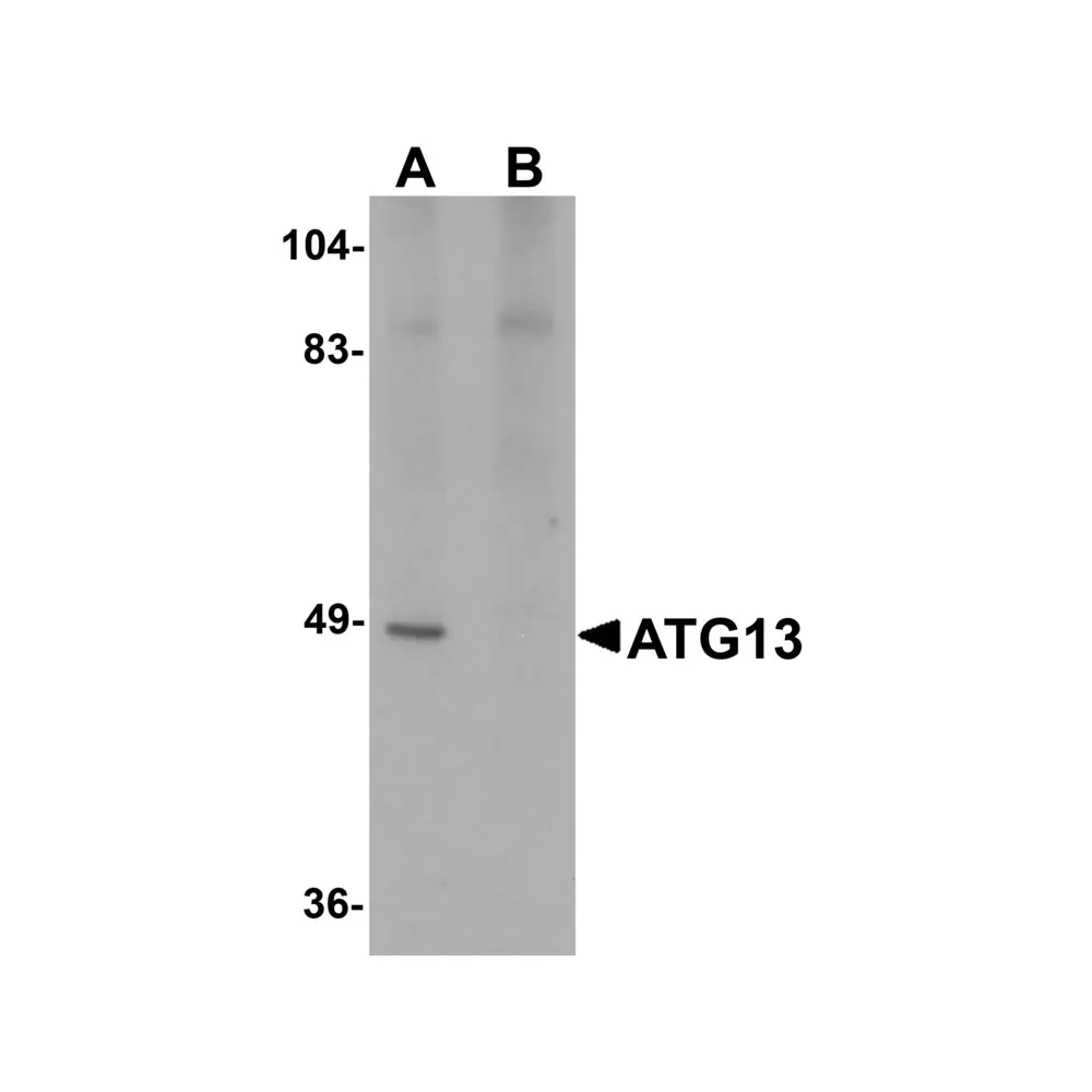 ProSci 5799 ATG13 Antibody, ProSci, 0.1 mg/Unit Primary Image