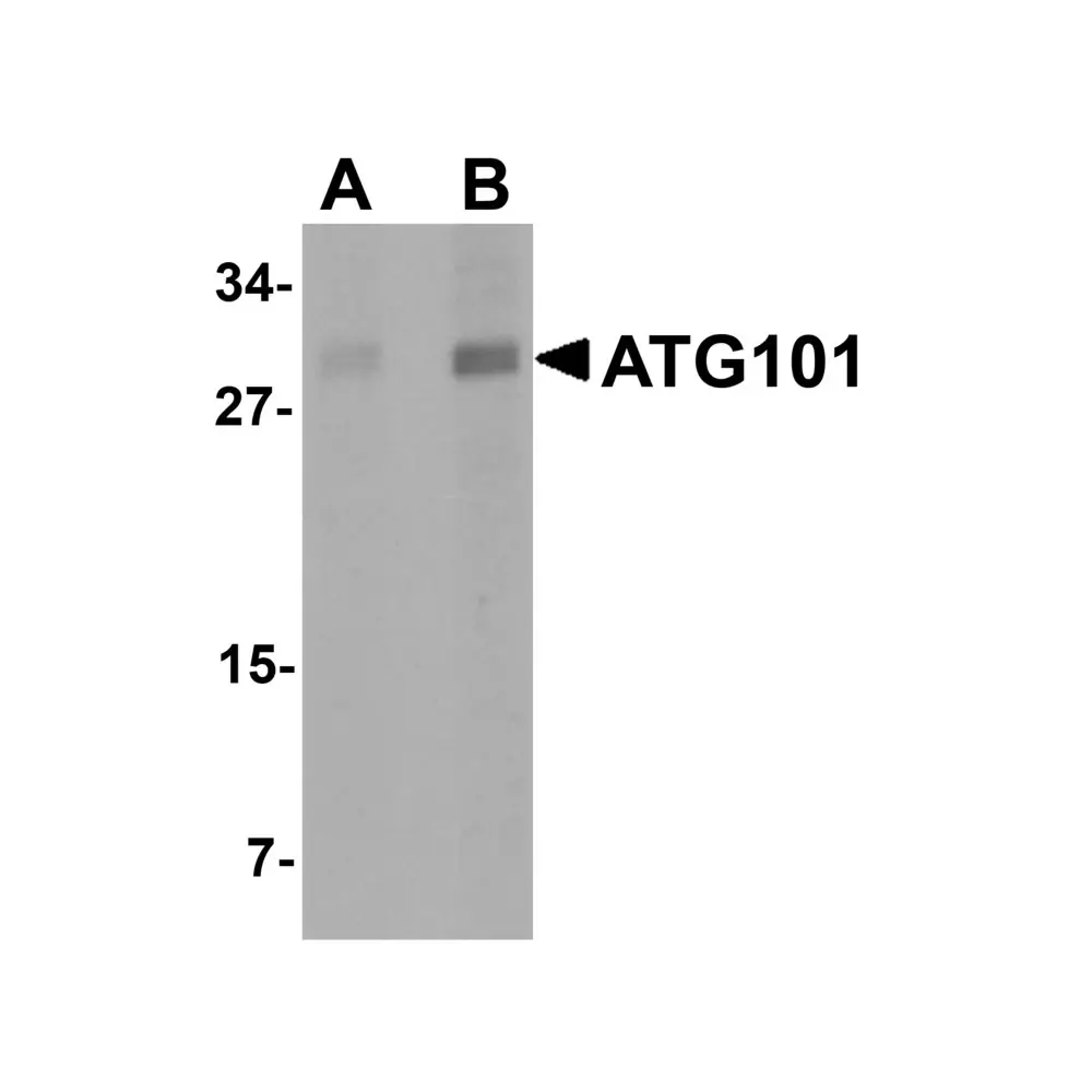 ProSci 5801 ATG101 Antibody, ProSci, 0.1 mg/Unit Primary Image