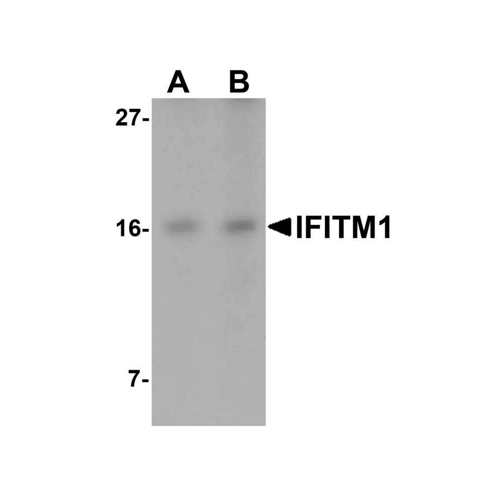 ProSci 5805 IFITM1 Antibody, ProSci, 0.1 mg/Unit Primary Image
