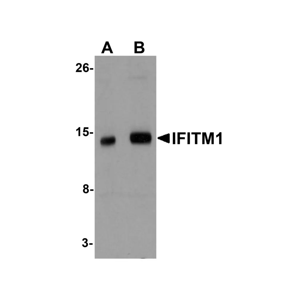 ProSci 5807 IFITM1 Antibody, ProSci, 0.1 mg/Unit Primary Image