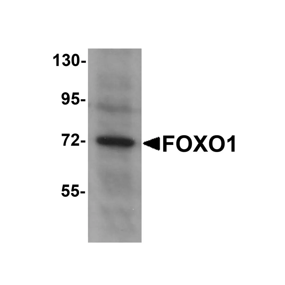 ProSci 5811 FOXO1 Antibody, ProSci, 0.1 mg/Unit Primary Image