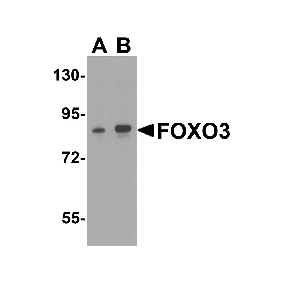 ProSci 5813_S FOXO3 Antibody, ProSci, 0.02 mg/Unit Primary Image
