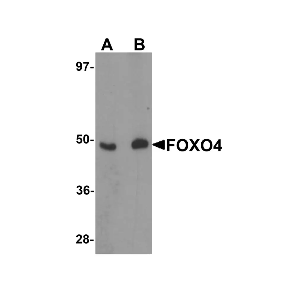 ProSci 5815_S FOXO4 Antibody, ProSci, 0.02 mg/Unit Primary Image