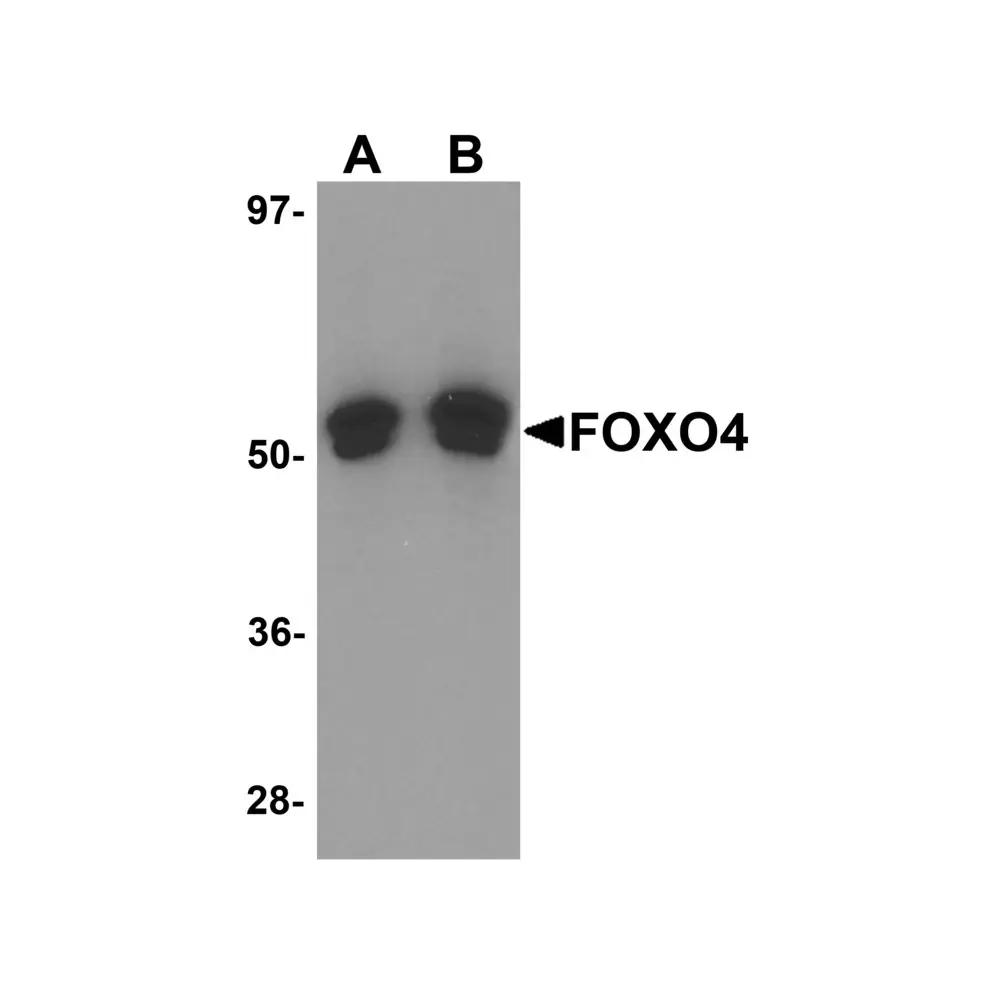 ProSci 5817 FOXO4 Antibody, ProSci, 0.1 mg/Unit Primary Image