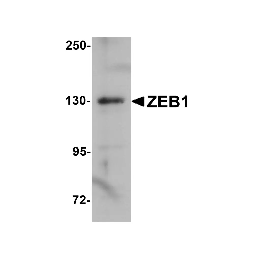 ProSci 5825 ZEB1 Antibody, ProSci, 0.1 mg/Unit Primary Image