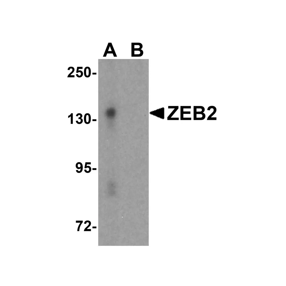 ProSci 5827 ZEB2 Antibody, ProSci, 0.1 mg/Unit Primary Image