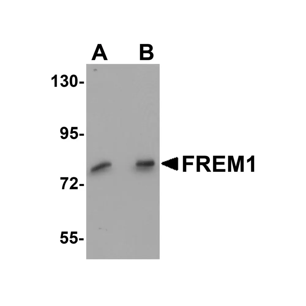 ProSci 5829 FREM1 Antibody, ProSci, 0.1 mg/Unit Primary Image