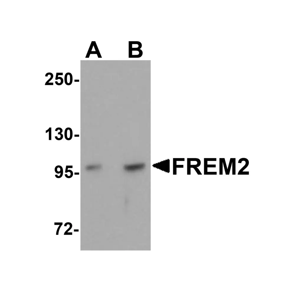 ProSci 5831 FREM2 Antibody, ProSci, 0.1 mg/Unit Primary Image