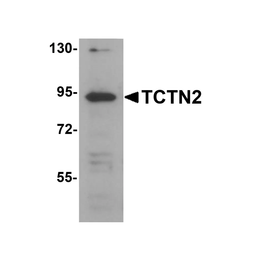 ProSci 5835 TCTN2 Antibody, ProSci, 0.1 mg/Unit Primary Image