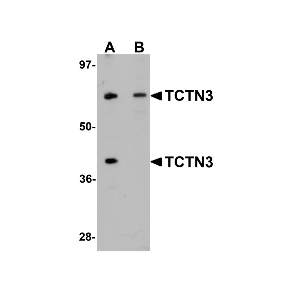 ProSci 5837_S TCTN3 Antibody, ProSci, 0.02 mg/Unit Primary Image