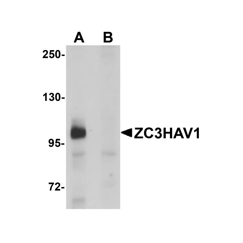 ProSci 5839_S ZC3HAV1 Antibody, ProSci, 0.02 mg/Unit Primary Image