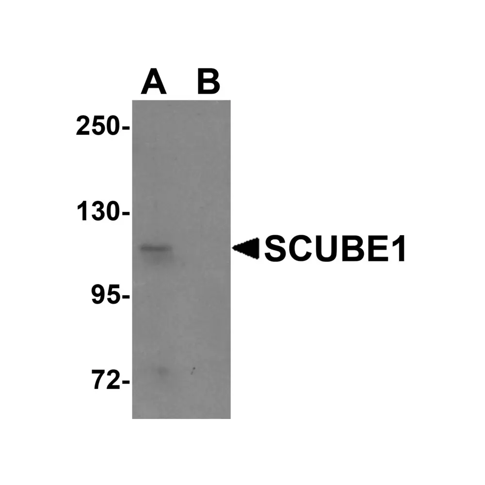 ProSci 5843 SCUBE1 Antibody, ProSci, 0.1 mg/Unit Primary Image