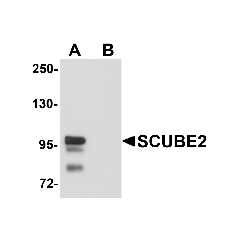 ProSci 5845 SCUBE2 Antibody, ProSci, 0.1 mg/Unit Primary Image