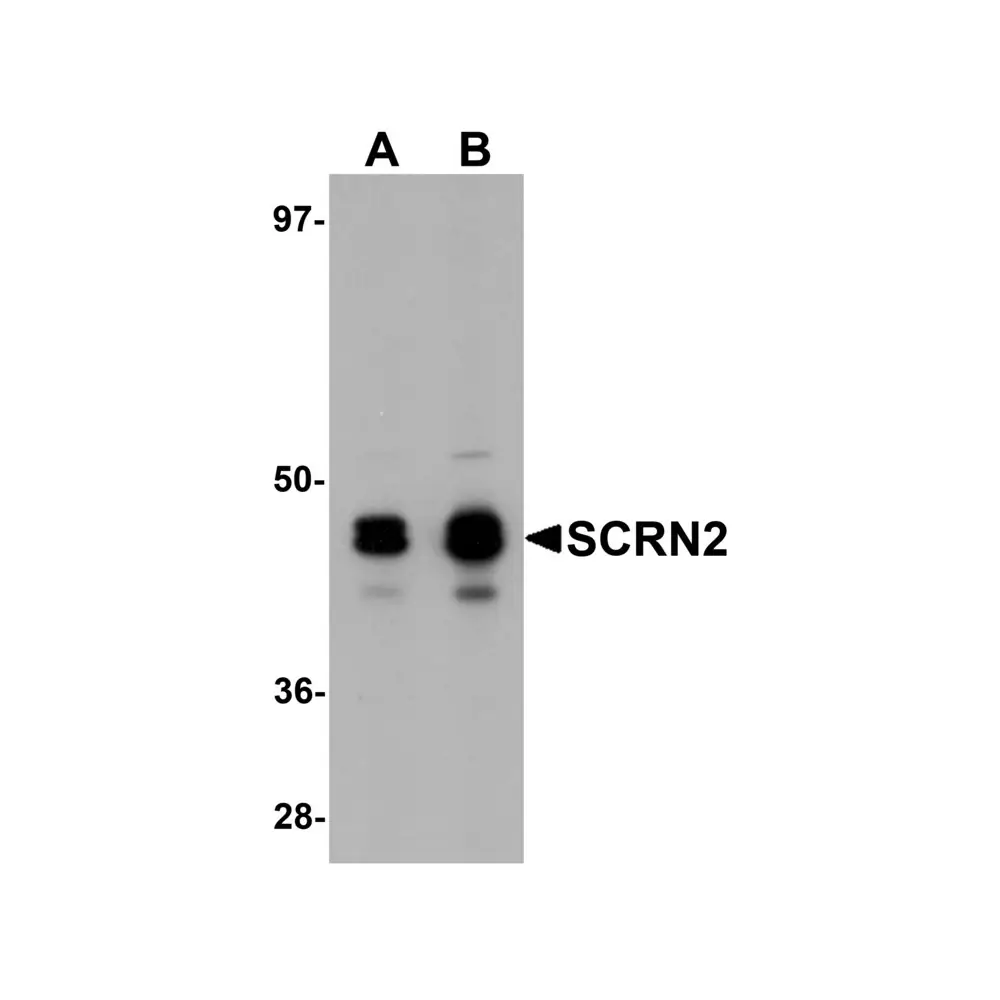 ProSci 5851_S SCRN2 Antibody, ProSci, 0.02 mg/Unit Primary Image