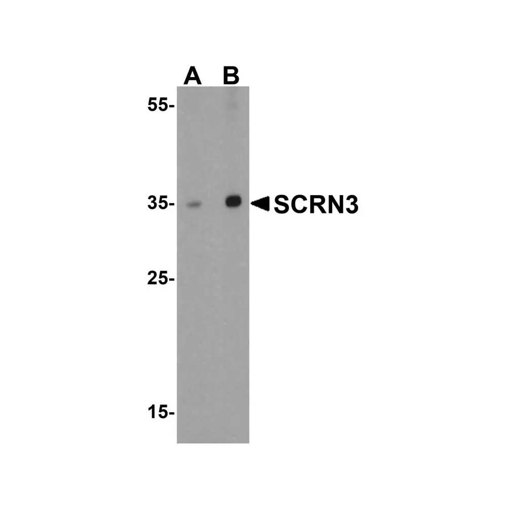 ProSci 5853 SCRN3 Antibody, ProSci, 0.1 mg/Unit Primary Image