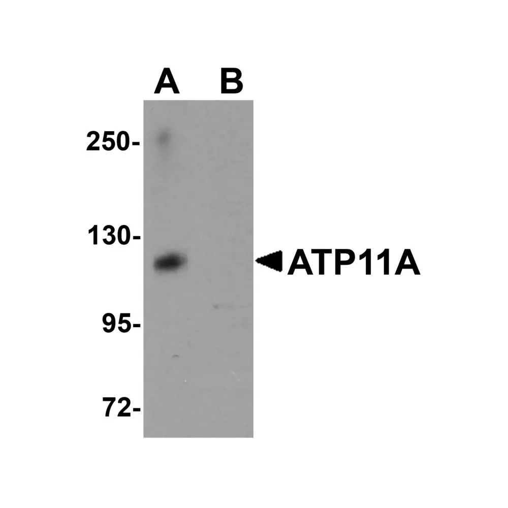 ProSci 5855_S ATP11A Antibody, ProSci, 0.02 mg/Unit Primary Image