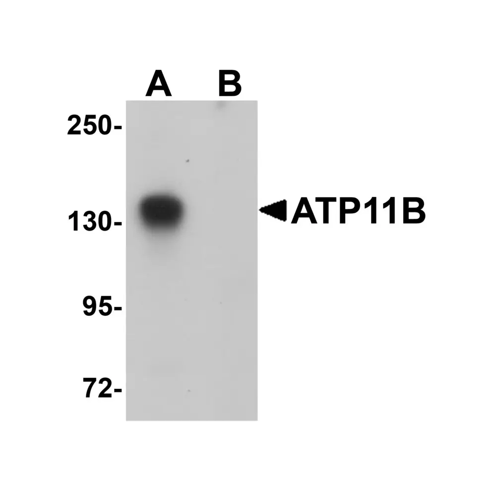 ProSci 5857_S ATP11B Antibody, ProSci, 0.02 mg/Unit Primary Image