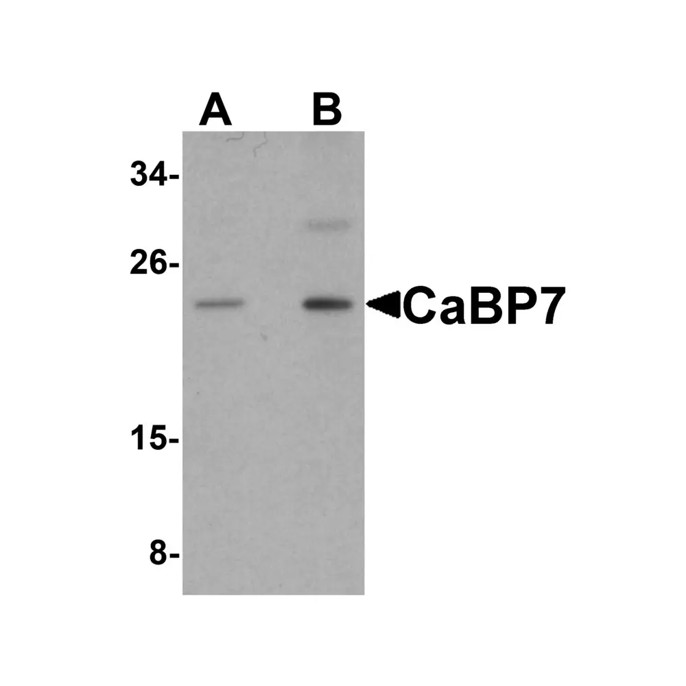 ProSci 5859_S CaBP7 Antibody, ProSci, 0.02 mg/Unit Primary Image