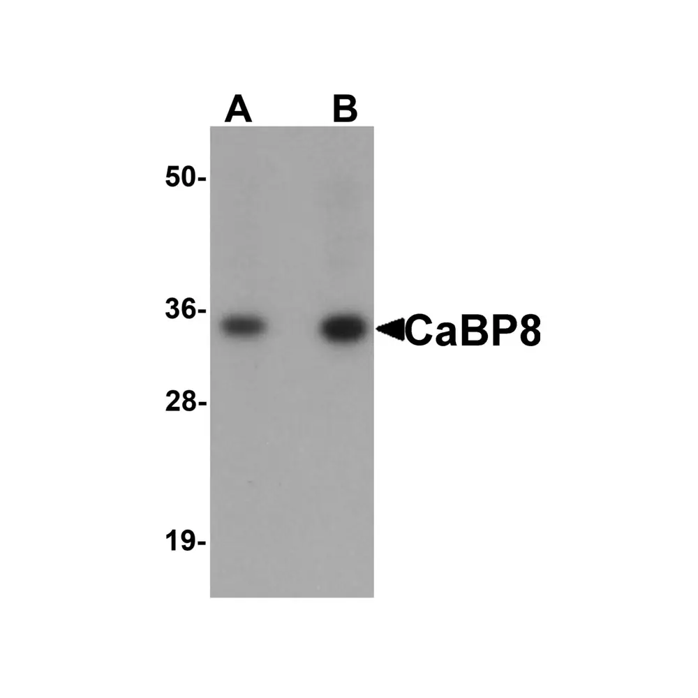 ProSci 5861 CaBP8 Antibody, ProSci, 0.1 mg/Unit Primary Image