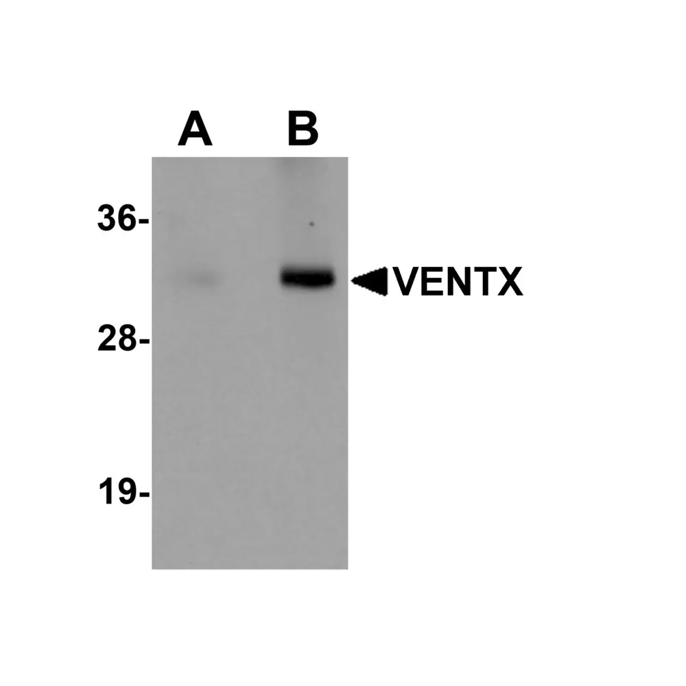 ProSci 5863 VENTX Antibody, ProSci, 0.1 mg/Unit Primary Image
