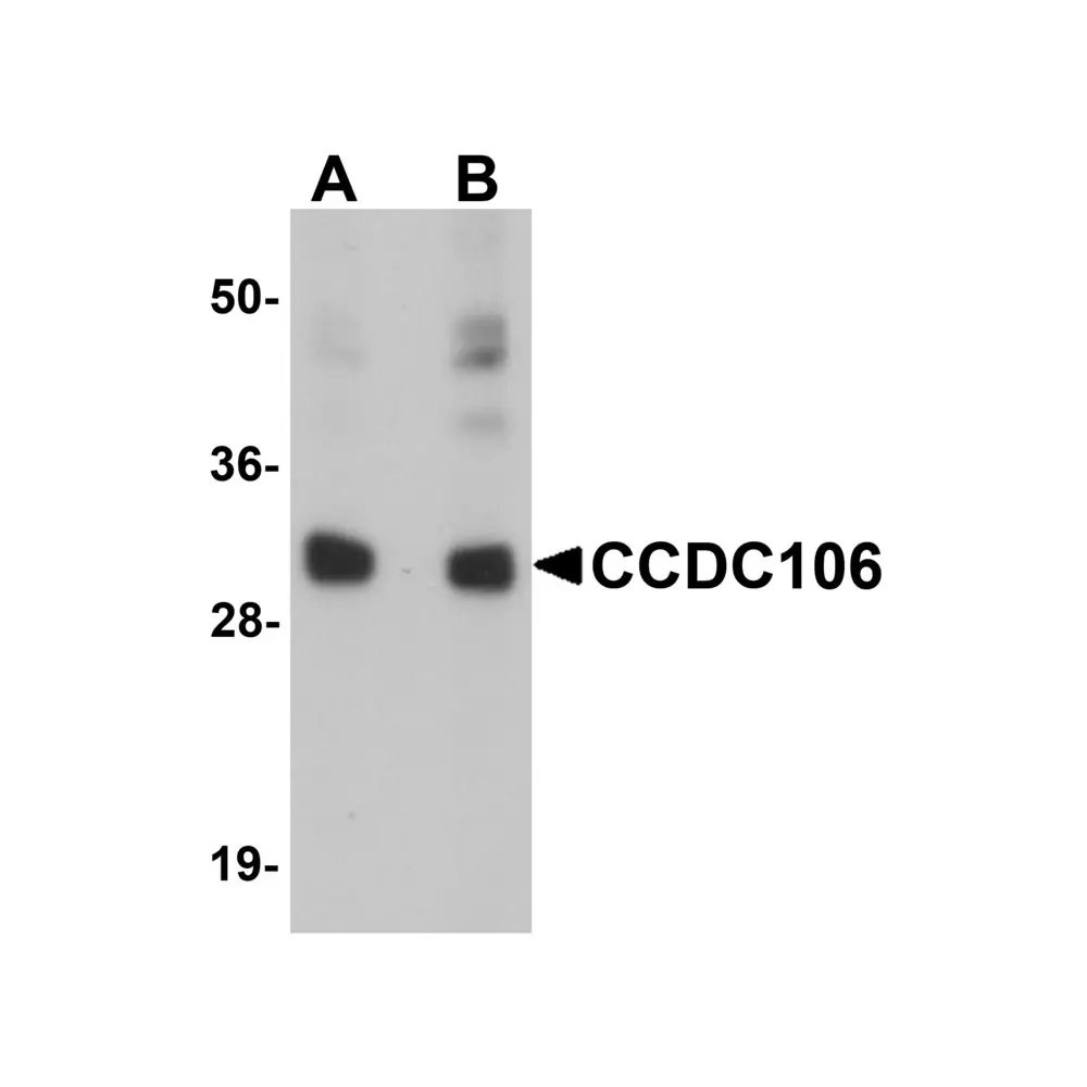ProSci 5865_S CCDC106 Antibody, ProSci, 0.02 mg/Unit Primary Image